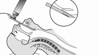 Laryngoscope Blade Use In ETI [upl. by Shaun]