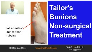 Tailors Bunion Best Practices  Seattle Podiatrist [upl. by Yzus]