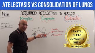 Atelectasis vs Consolidation of Lungs  Respiratory Pathology🫁 [upl. by Ennobe]