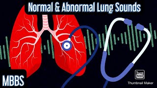 Normal amp Abnormal Lung sounds Wheeze Rhonchi Crepitus Stridor mbbs medicine neetpg [upl. by Hareema924]