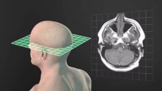 Anatomical Planes  Animated Tutorial [upl. by Dong]