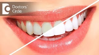 Teeth cleaning vs teeth whitening  Dr Sumanth M Shetty [upl. by Mientao]