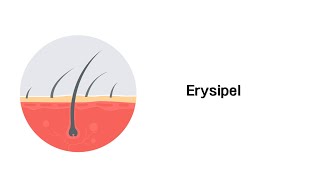 Erysipel  Hauterkrankungen mit Infoleiste [upl. by Prouty]