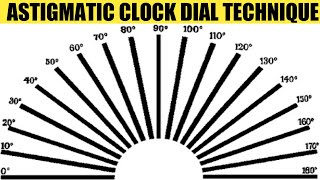 Astigmatic Clock Dial amp Fogging Technique  AK Khurana  Dr Saud Javed [upl. by Adolph]