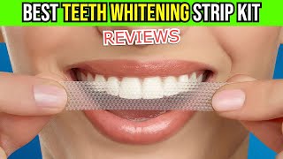 ✨ Transform Your Smile Crest 3D Whitestrips Kit Review 🦷  Does It Really Work [upl. by Valentina]