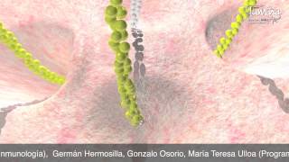 Infección Gastrointestinal por Shigella [upl. by Barnabe]