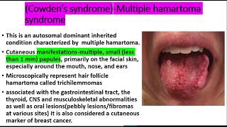 Squamous cell papilloma EVERYTHING you need to knowEtiologyclinical features histopath treatment [upl. by Chabot]