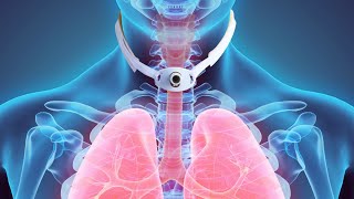 Tracheostomy vs Laryngectomy [upl. by Nnagem]