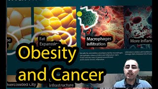 There is no quotHealthy Obesityquot  all obesity Causes cancer [upl. by Hillie464]