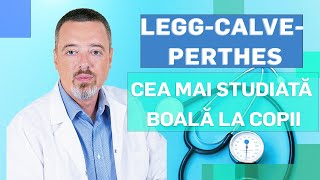 LeggCalvePerthes cea mai studiată boală a copilului [upl. by Dnalyram409]