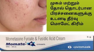 momate f cream review tamil Best cream for clear skinmosquito bite and skin allergy [upl. by Wilhide]