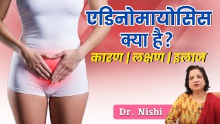 ✅ एडिनोमायोसिस क्या है Adenomyosis Symptoms Causes And Treatment in Hindi  💹 Adenomyosis in Hindi [upl. by Macy76]