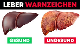 5 Gefährliche WarnZeichen deiner Leber [upl. by Kilgore29]