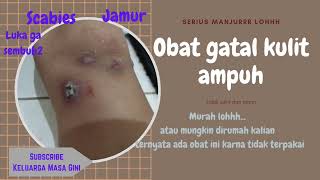 obat gatal obat luka ampuh murah [upl. by Nivonod]