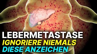 5 Lebensrettende Symptome von Lebermetastasen die du sofort erkennen solltest [upl. by Melone]