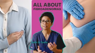 All about Fibroadenomas  with Dr Tasha [upl. by Tiffa597]