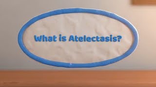 What is Atelectasis Complete or Partial Lung Collapse [upl. by Llacam542]