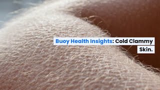 Cold Clammy Skin Common Causes and When to Seek Medical Care  BuoyHealthcom [upl. by Weasner]