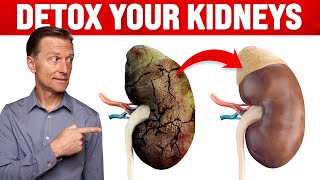 A Surprising Way to Cleanse Toxic Kidneys  Dr Berg on Kidney Detoxification [upl. by Hey]