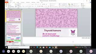 thyroid tumors [upl. by Ary]