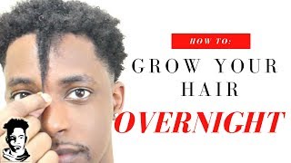 How To Grow Your Hair OVERNIGHT  WINSTONEE [upl. by Arlo]