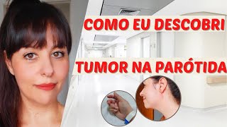 Como eu descobri meu tumor de parótida glândula salivar [upl. by Imeaj692]