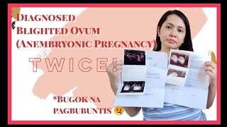 Diagnosed Blighted Ovum TWICE Tagalog  momlifewithdally [upl. by Roseline]