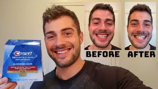 Crest 3D Whitestrips  How To Whiten Your Teeth At Home  Full 14 Days Review [upl. by Yerd]