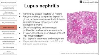 Glomerular diseases [upl. by Nairrod468]