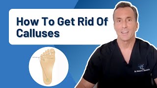 How Do You Get Rid Of Calluses Permanently [upl. by Liesa]