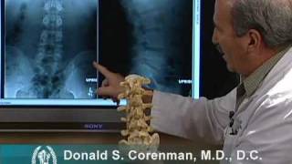 How to Read Xrays of the Lumbar Spine Lower Back  Spine Surgeon Colorado [upl. by Bartlett982]