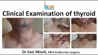 Clinical examination amp skill labs 34 Thyroid examination 3   by Dr Wahdan [upl. by Wappes]