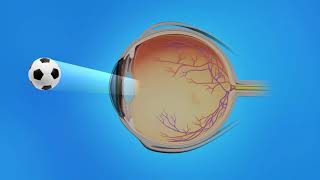 AgeRelated Macular Degeneration AMD Types Causes Symptoms Treatment [upl. by Dnalra820]