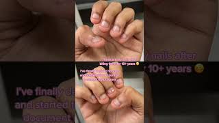 do you bite your nails 😓nailgrowthjourney6 nails nailart naildesign nailtech [upl. by Euqina771]