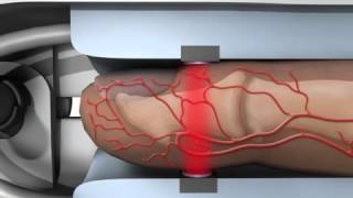 Pulse Oximetry NEJM [upl. by Lotte]