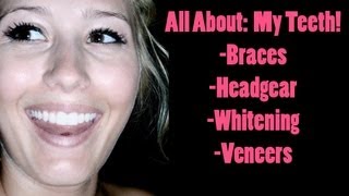 All About My Teeth Braces Headgear Whitening and Veneers [upl. by Aikcin237]