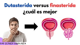 🔴 TAMSULOSINA DUTASTERIDA VS FINASTERIDA PARA LA HIPERPLASIA PROSTÁTICA BENIGNA ¿CUÁL ES MEJOR [upl. by Diego]