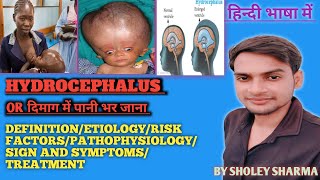 Hydrocephalus  Causes  Signs and Symptoms Diagnosis and Treatment  Bsc nursing  GNM ANM [upl. by Hurst970]