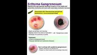 Ecthyma gangrenosum [upl. by Daloris]