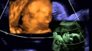 Ultrasound images of baby at 30 weeks of pregnancy [upl. by Akcirederf]