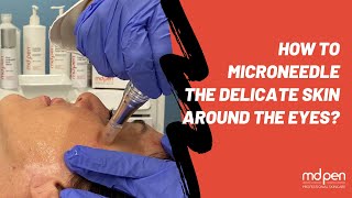 How to Microneedle the delicate skin around the eyes [upl. by Shaylynn919]