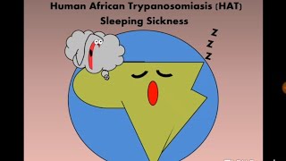 Human African Trypanosomiasis HAT Tbrucei مرض النوم [upl. by Salvadore934]