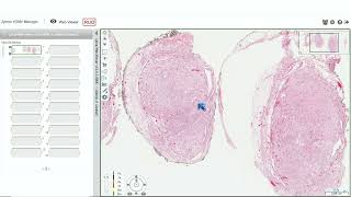 Digital Slide Pathology Review A Case Based Approach to Common Problems in Surgical Pathology [upl. by Yirinec562]