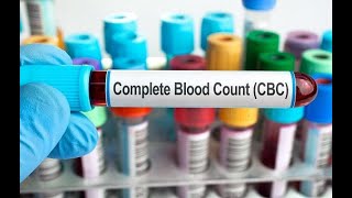 Complete Blood Count Interpretation CBC by ASM Minds Team [upl. by Erihppas]