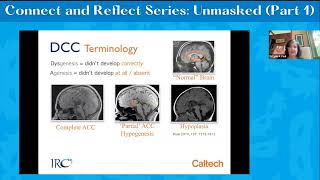 Unmasked Part 1 A Discussion about the Relationship between ACC amp Psychiatric Diagnoses [upl. by Vyner]