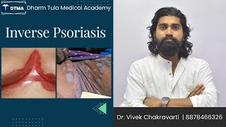 Inverse psoriasis  Psoriasis  Skin Disease  Skin psoriasis psoriasiscure psoriasissolution [upl. by Eenaffit]