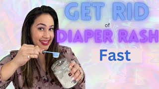 5 Home Remedies for Diaper Rash That Really Work Natural Diaper Rash Remedies [upl. by Grossman955]