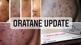 Oratane Update  Oratane Treatment Journey  South African YouTuber [upl. by Comyns]