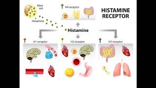 Managing histamine intolerance [upl. by Ramad]