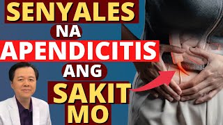 Senyales na Appendicitis ang Sakit Mo  By Doc Willie Ong Internist and Cardiologist [upl. by Coshow]